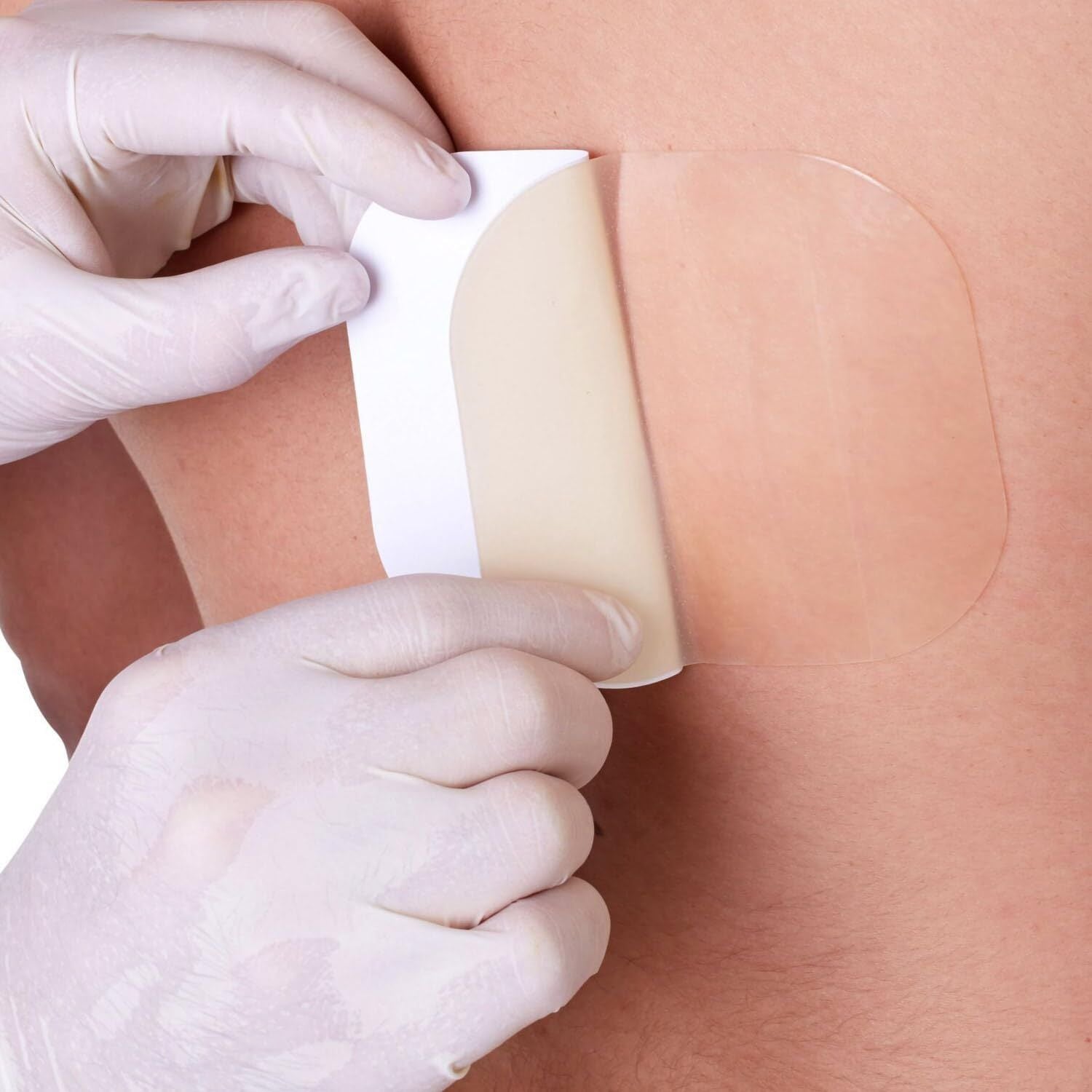 Medstock Medstock Hydrocolloid Dressing