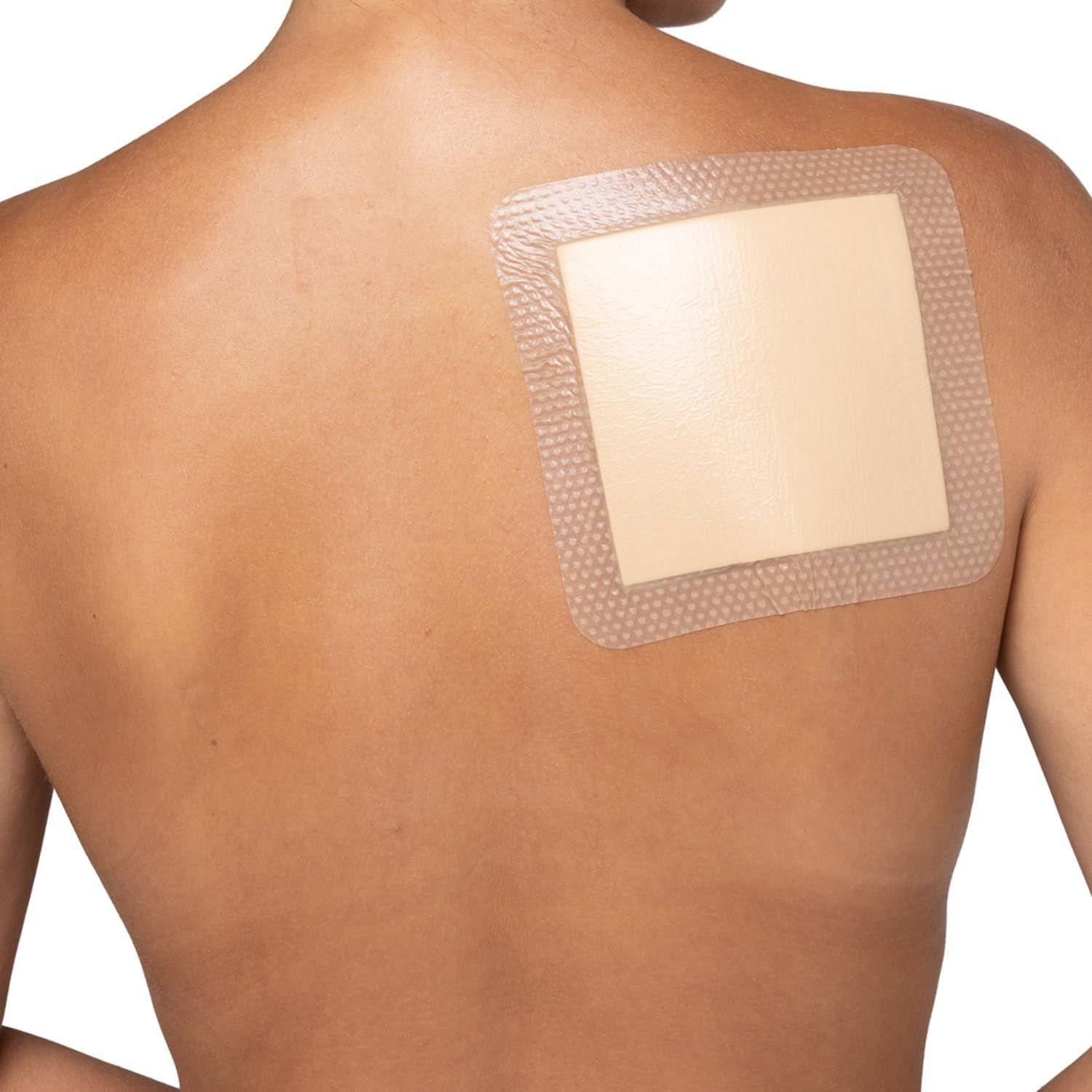 Medstock Medstock Silicone Foam Border