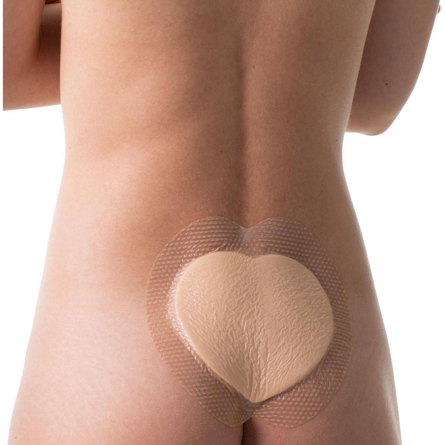Medstock Medstock Silicone Foam Border Sacrum